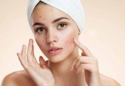 Acnes